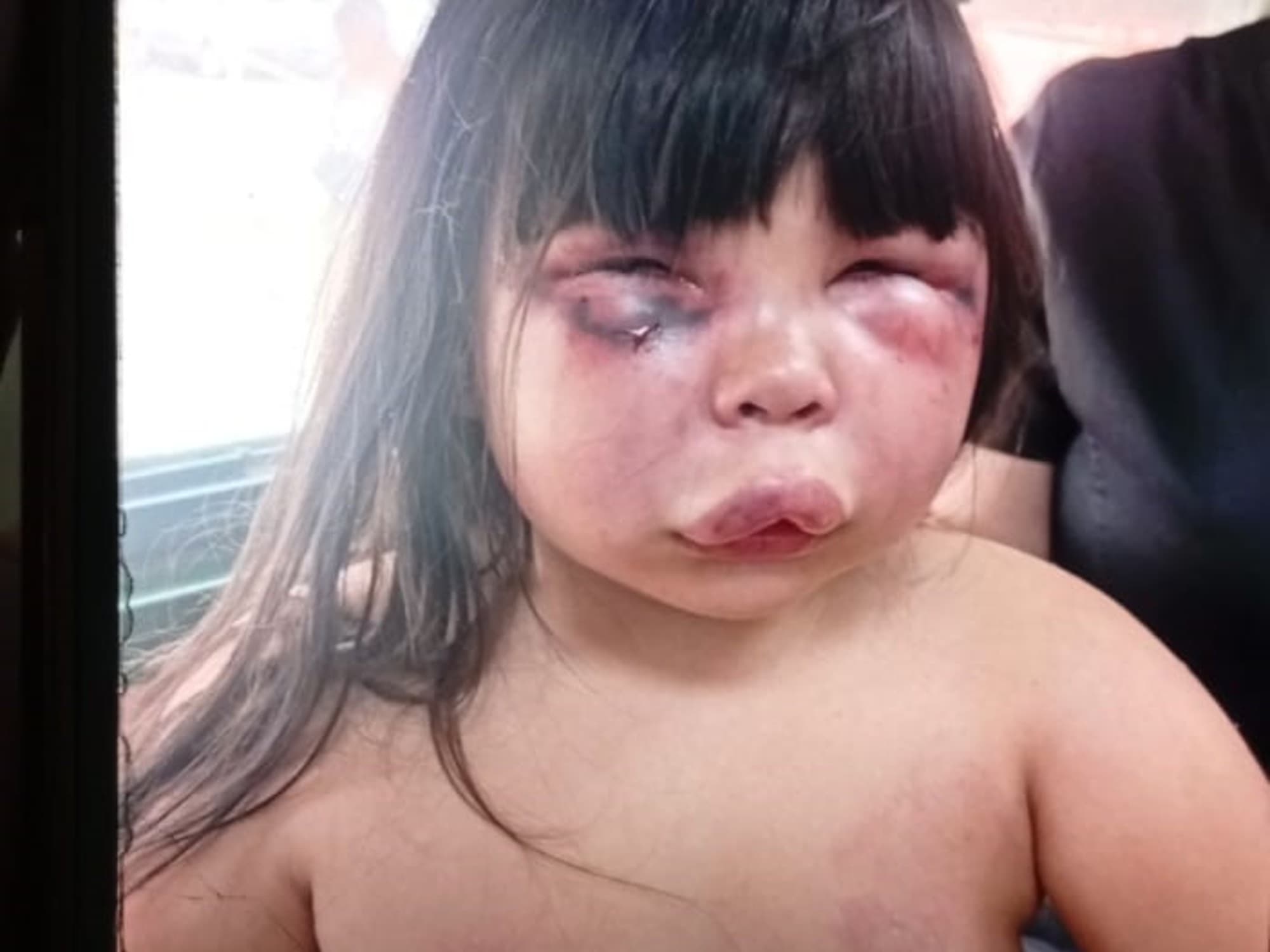 Violencia familiar en Gerli: fallas del sistema de protección